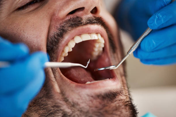 Best Emergency Dentist for Special Needs Patients in Meadow Glade, WA