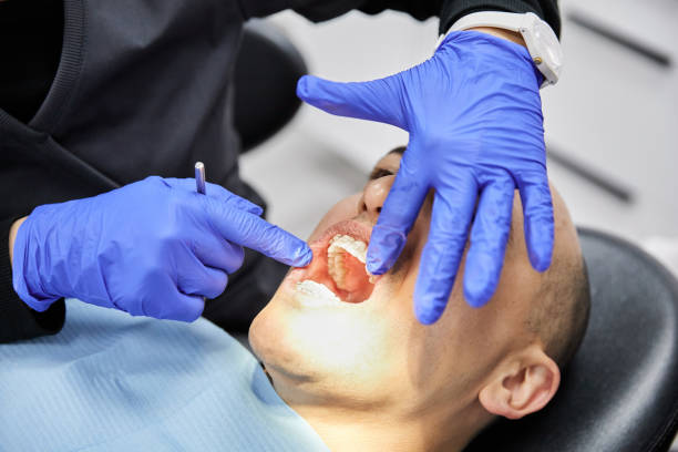 Best Emergency Dental Extractions in Meadow Glade, WA